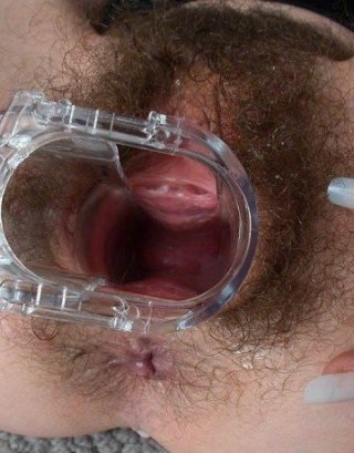 Огромная вывернутая вагина (61 фото)